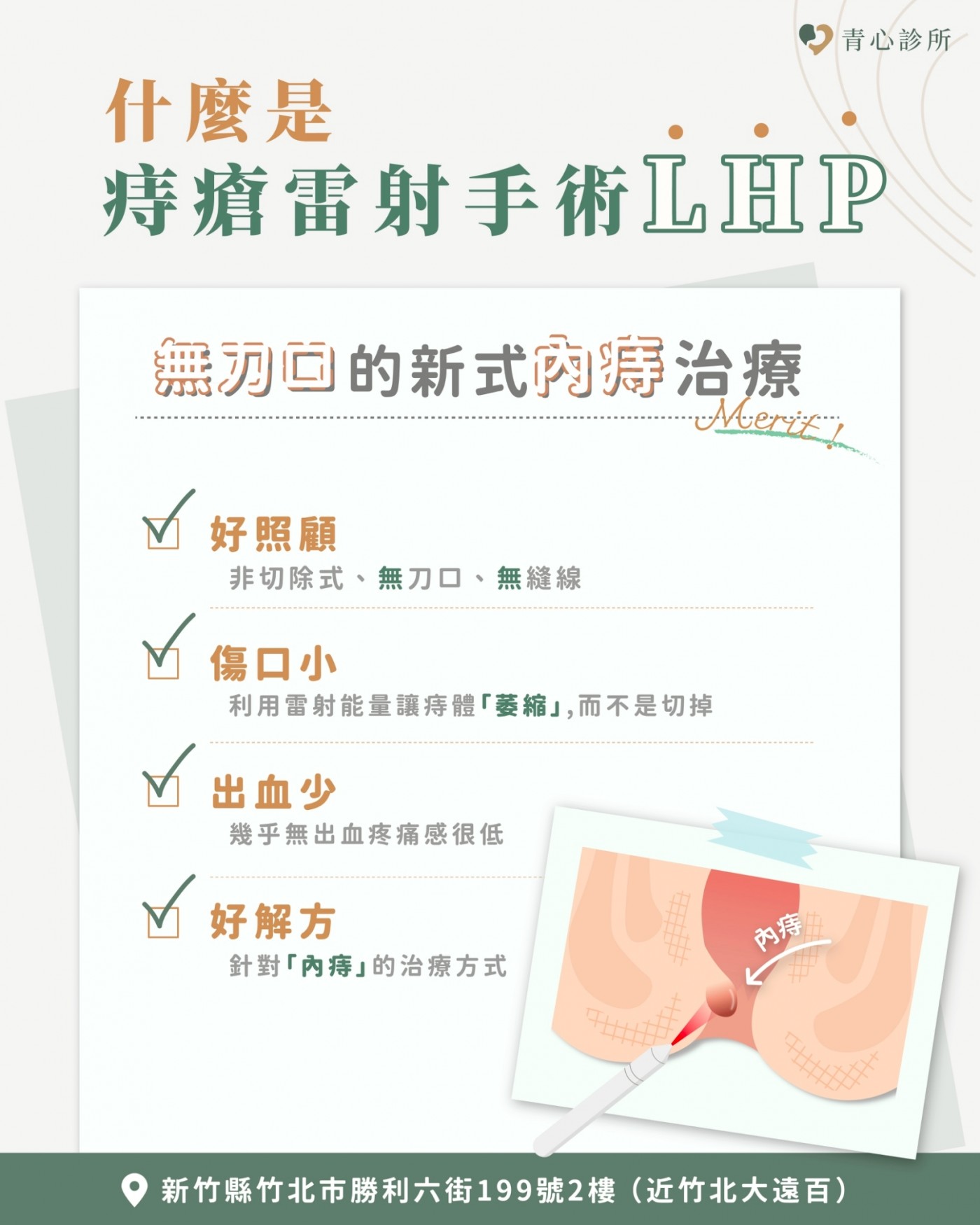 新竹竹北 青心診所  痔瘡雷射手術 痔瘡雷射手術簡介 痔瘡雷射消融優點