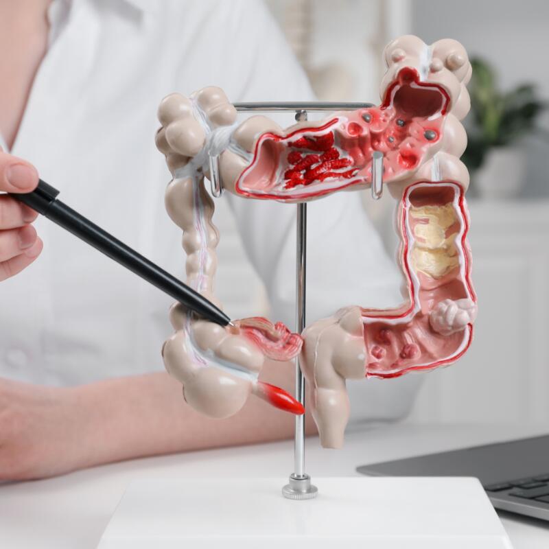 竹北無痛大腸鏡檢查